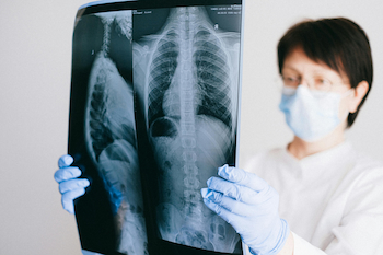 medical specialist examining xray of human spine